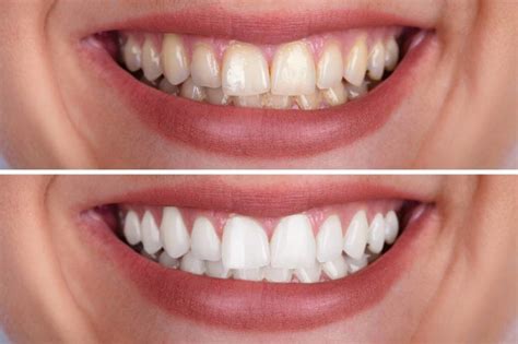 white clay dental|White Clay Dental